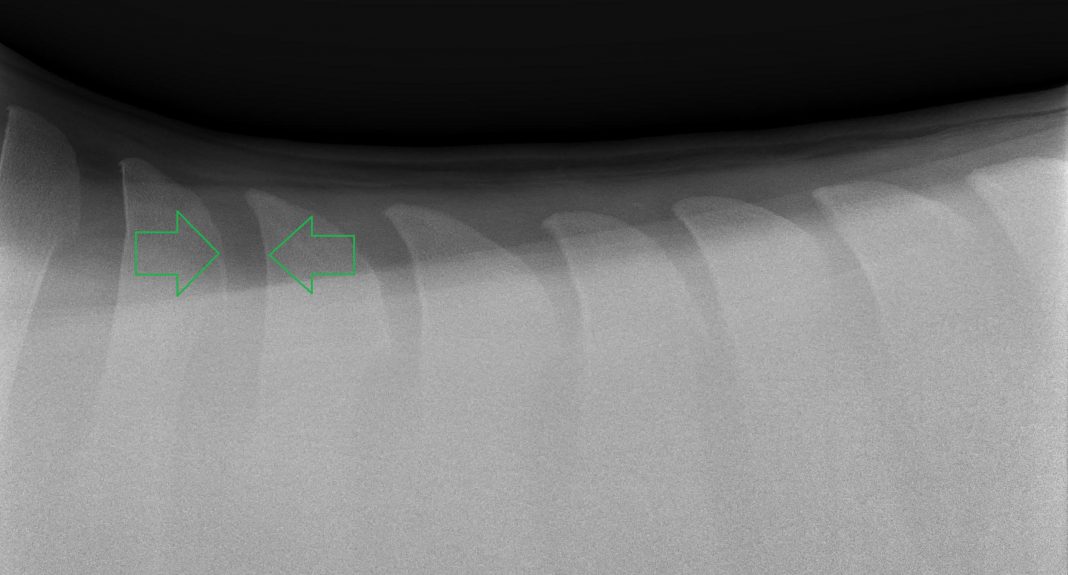 Understanding Kissing Spines The Plaid Horse Magazine